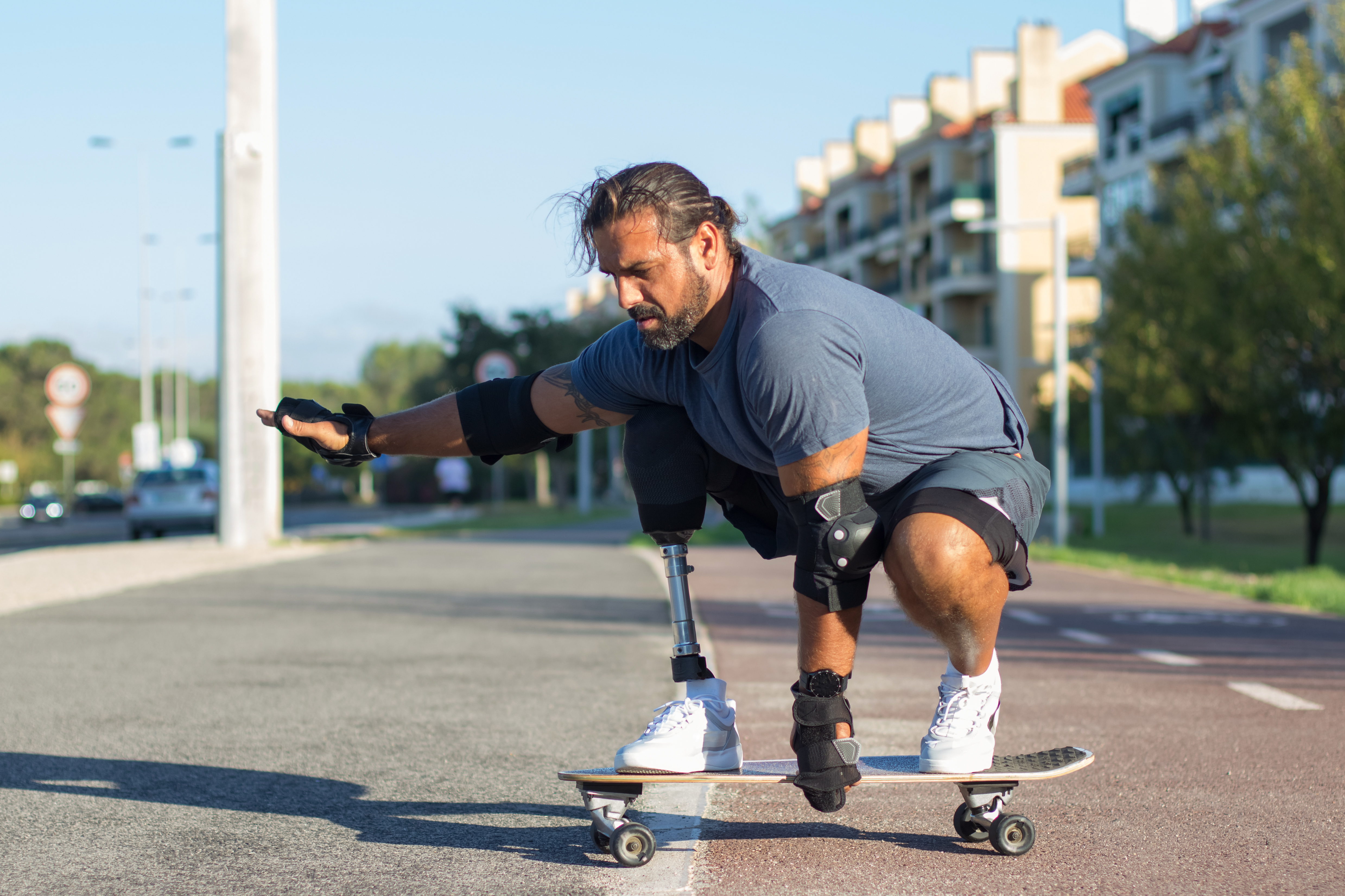 Personalized prosthetic consultation and care